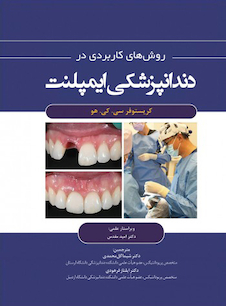 عکس روش های کاربردی در دندانپزشکی ایمپلنت 2021