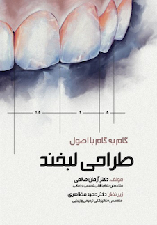 عکس گام به گام با اصول طراحی لبخند
