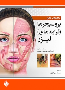 عکس راهنمای جامع پروسیجرها فرایندهای لیزر