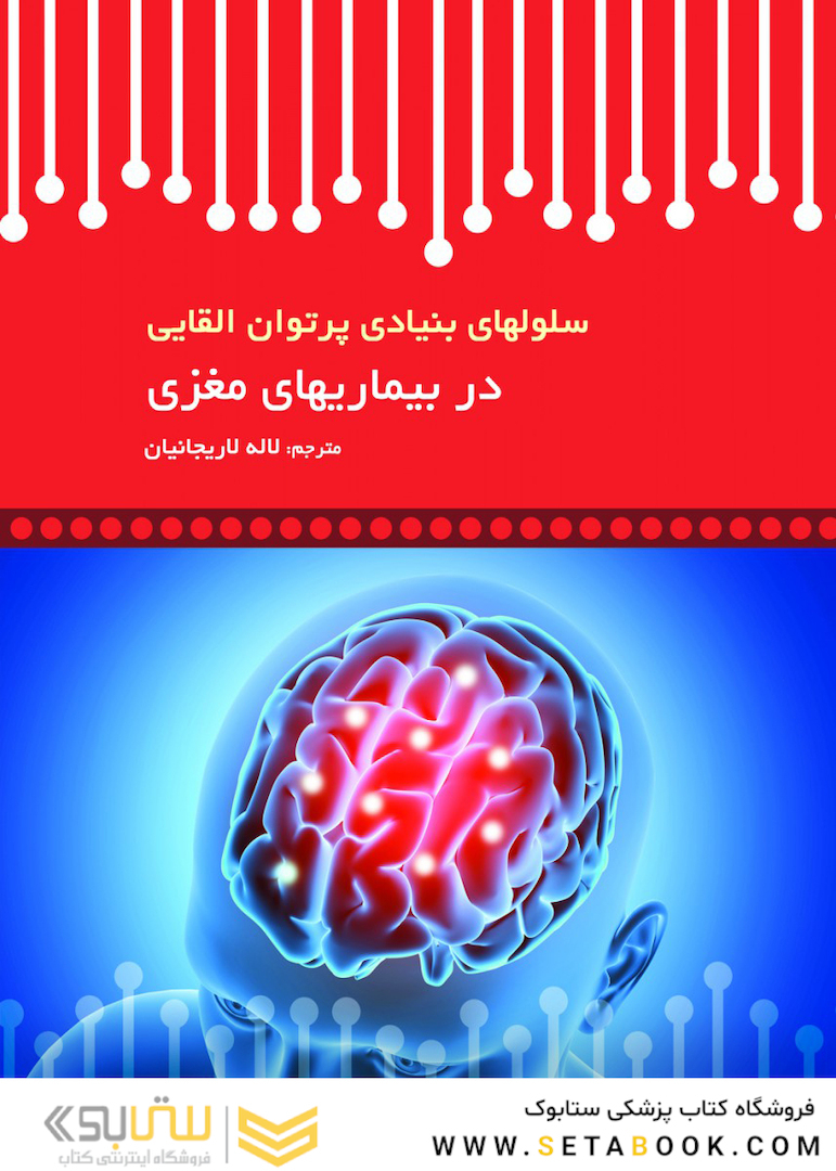 سلولهای بنیادی پرتوان القایی در بیماریهای مغزی