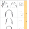 طراحی پروتز پارسیل (اصول و مبانی)