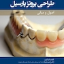 طراحی پروتز پارسیل (اصول و مبانی)