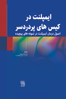 عکس ایمپلنت در کیس های پر دردسر (اصول درمان ایمپلنت در نمونه های پیچیده)