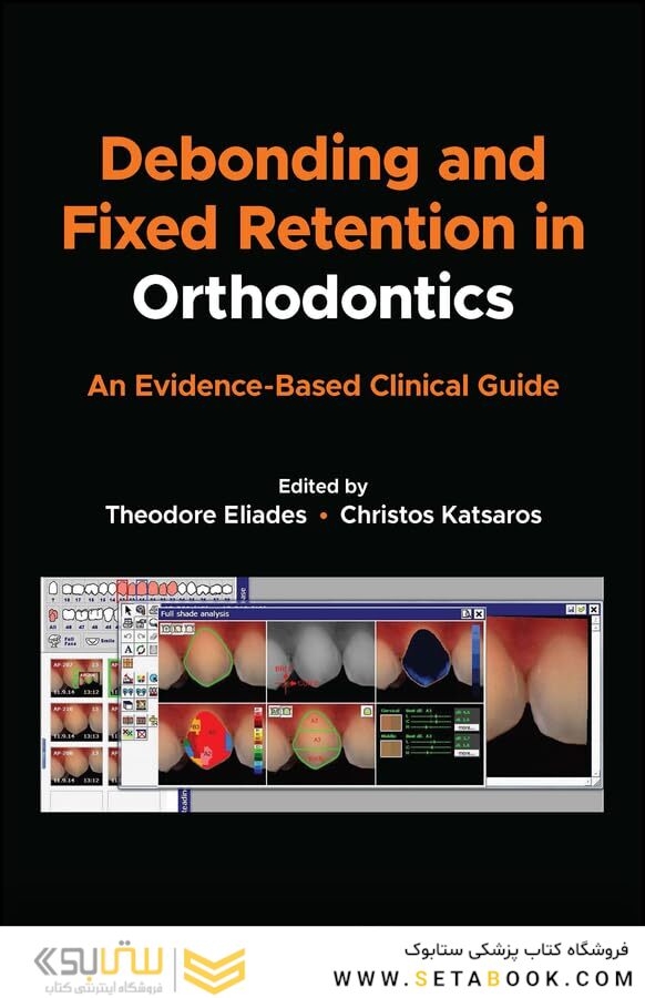 Debonding and Fixed Retention in Orthodontics: An Evidence-Based Clinical Guide 1st Edicion 2024