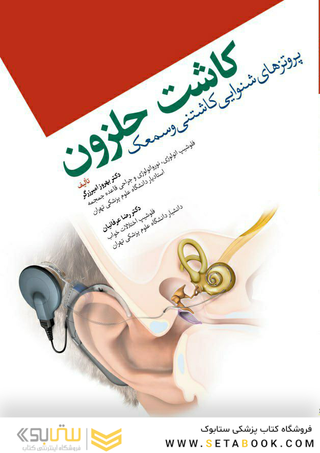 کاشت حلزون
