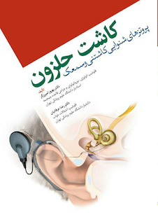 عکس کاشت حلزون