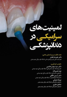 عکس لمینیت های سرامیکی در دندانپزشکی