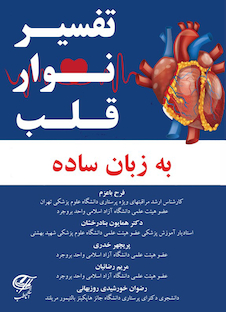 عکس تفسیر نوار قلب به زبان ساده