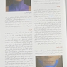ضروریات آناتومی در تزریق های زیبایی صورت