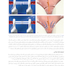 میکروجراحی پلاستیک در پریودنتال و پری ایمپلنت تکنیکهای کم تهاجمی با حداکثر دقت