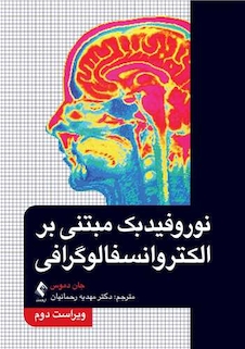 عکس نوروفیدبک مبتنی بر الکتروانسفالوگرافی