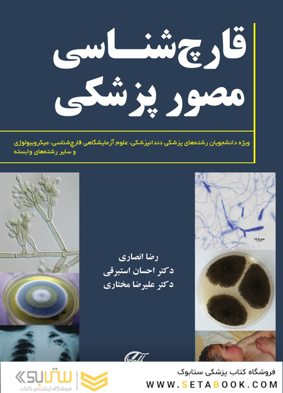 قارچ شناسى مصور پزشکى