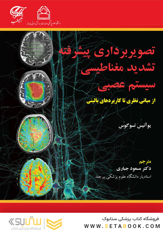 تصویربرداری پیشرفته تشدید مغناطیسی سیستم عصبی