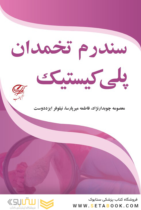 سندرم تخمدان پلی کیستیک