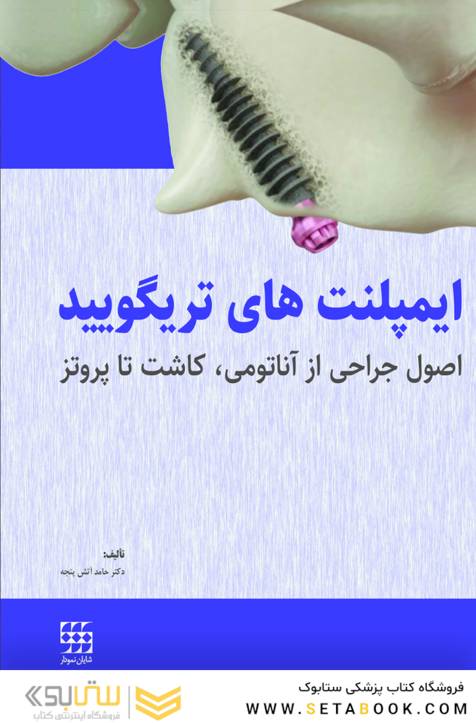 ایمپلنت های تریگویید اصول جراحی از آناتومی، کاشت تا پروتز
