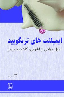 عکس ایمپلنت های تریگویید اصول جراحی از آناتومی، کاشت تا پروتز