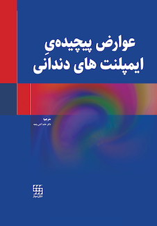 عکس عوارض پیچیده ایمپلنت های دندانی