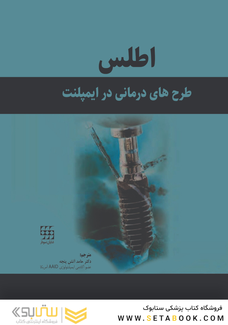 اطلس طرح های درمانی در ایمپلنت