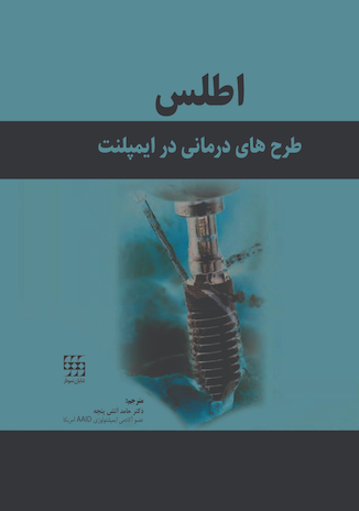 عکس اطلس طرح های درمانی در ایمپلنت