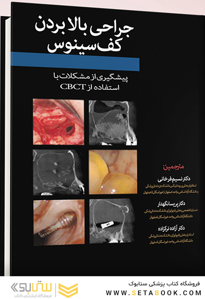 جراحی بالا بردن کف سینوس