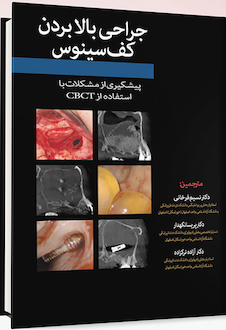 عکس جراحی بالا بردن کف سینوس