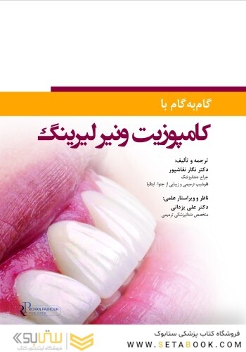 گام به گام با کامپوزیت ونیر لیرینگ