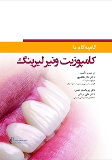 عکس گام به گام با کامپوزیت ونیر لیرینگ