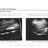 Pocket Protocols for Sonography Scanning 4th Edition 2015