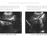Pocket Protocols for Sonography Scanning 4th Edition 2015