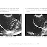 Pocket Protocols for Sonography Scanning 4th Edition 2015