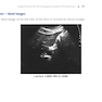Pocket Protocols for Sonography Scanning 4th Edition 2015