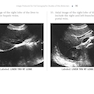 Pocket Protocols for Sonography Scanning 4th Edition 2015