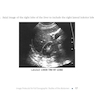 Pocket Protocols for Sonography Scanning 4th Edition 2015