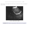 Pocket Protocols for Sonography Scanning 4th Edition 2015