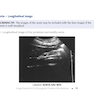 Pocket Protocols for Sonography Scanning 4th Edition 2015