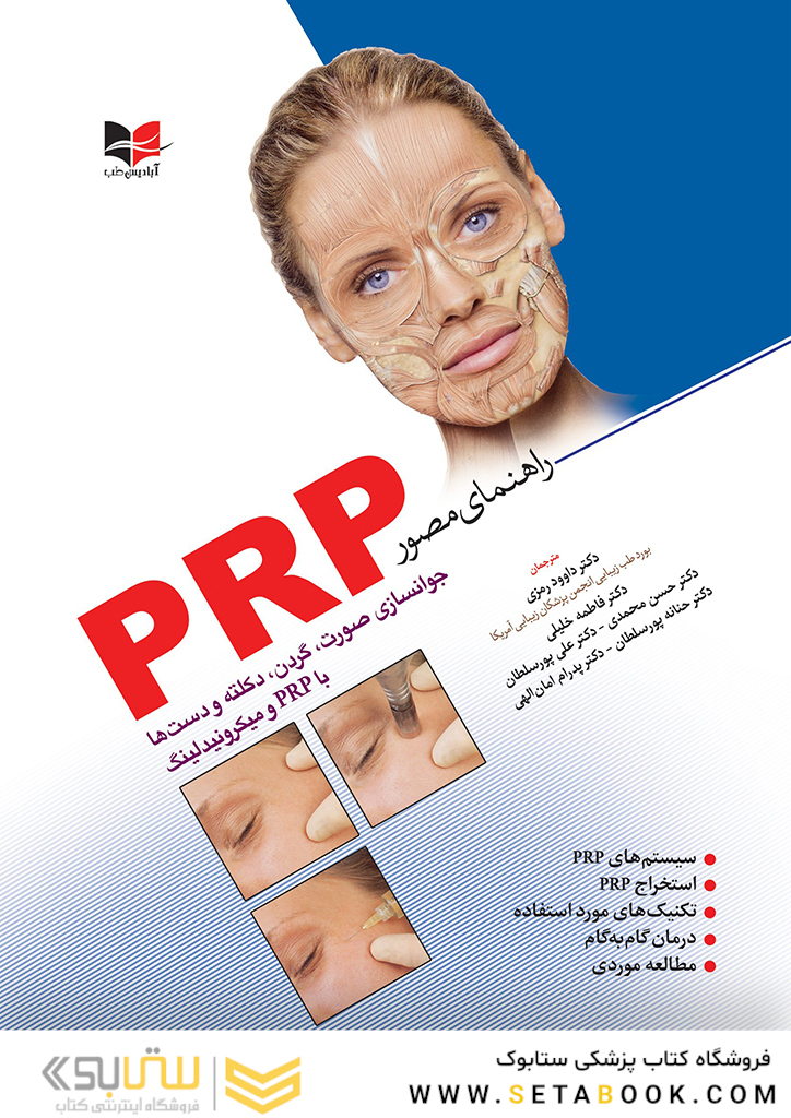 راهنمای مصور PRP