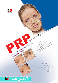 عکس راهنمای مصور PRP