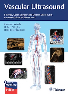 عکس Vascular Ultrasound: B-Mode, Color Doppler and Duplex Ultrasound, Contrast-Enhanced Ultrasound 1st Edition