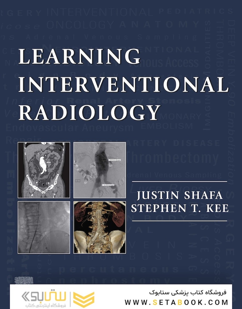 Learning Interventional Radiology 1st Edition