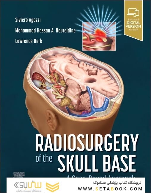 Radiosurgery of the Skull Base: A Case-Based Approach 1st Edition