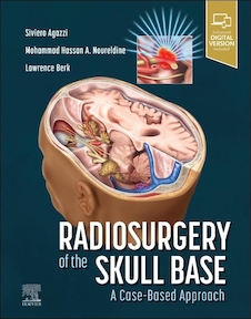 عکس Radiosurgery of the Skull Base: A Case-Based Approach 1st Edition