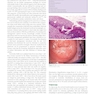 DiSaia and Creasman Clinical Gynecologic Oncology 10th Edition