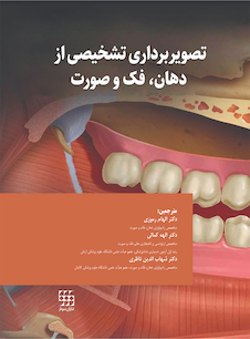 عکس تصویربرداری تشخیصی از دهان، فک و صورت