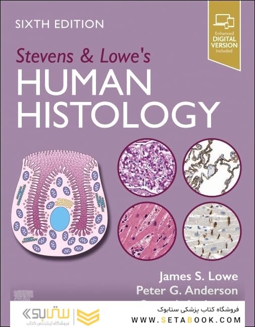 Stevens & Lowe