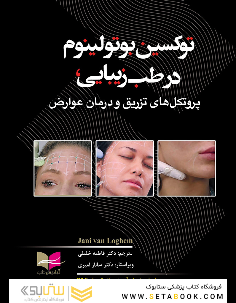 توکسین بوتولینوم در طب زیبایی، پروتکل های تزریق و درمان عوارض