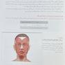 توکسین بوتولینوم در طب زیبایی، پروتکل های تزریق و درمان عوارض