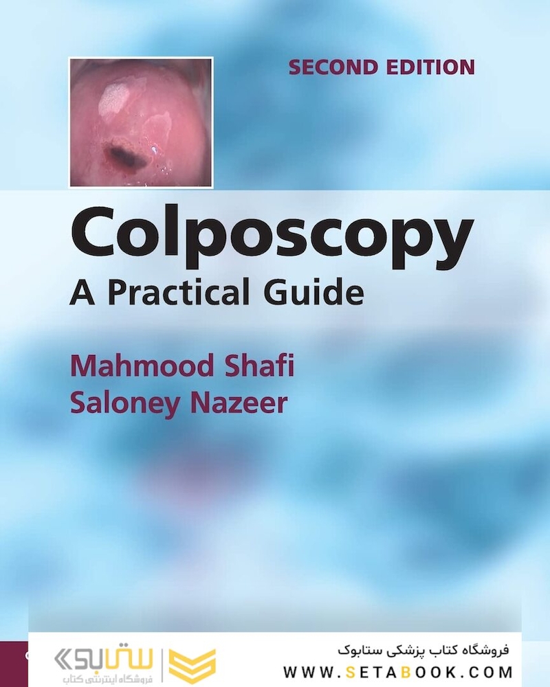 Colposcopy: A Practical Guide 2nd Edition
