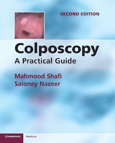 عکس Colposcopy: A Practical Guide 2nd Edition