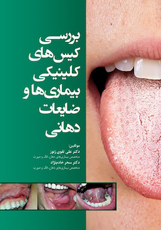 عکس بررسی کیس های کلینیکی بیماریها و ضایعات دهانی