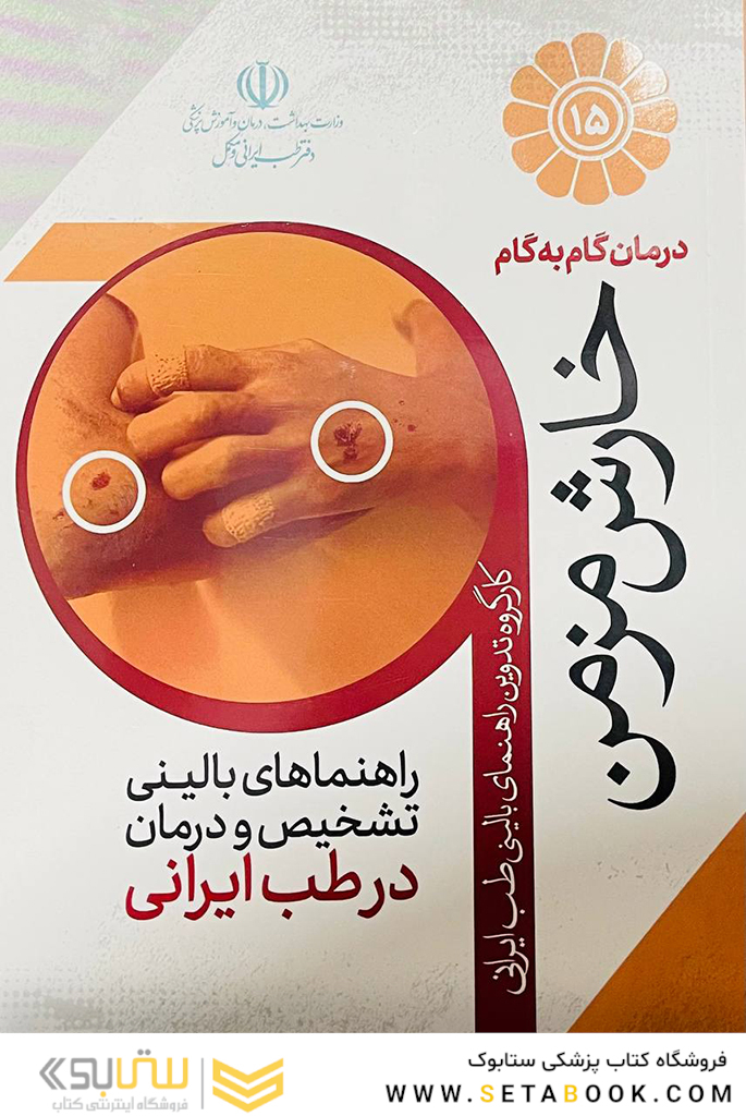 درمان گام به گام خارش مزمن